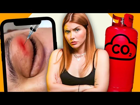 УКОЛ под КОЖУ 😵 Лицо ОПУХЛО после салона!