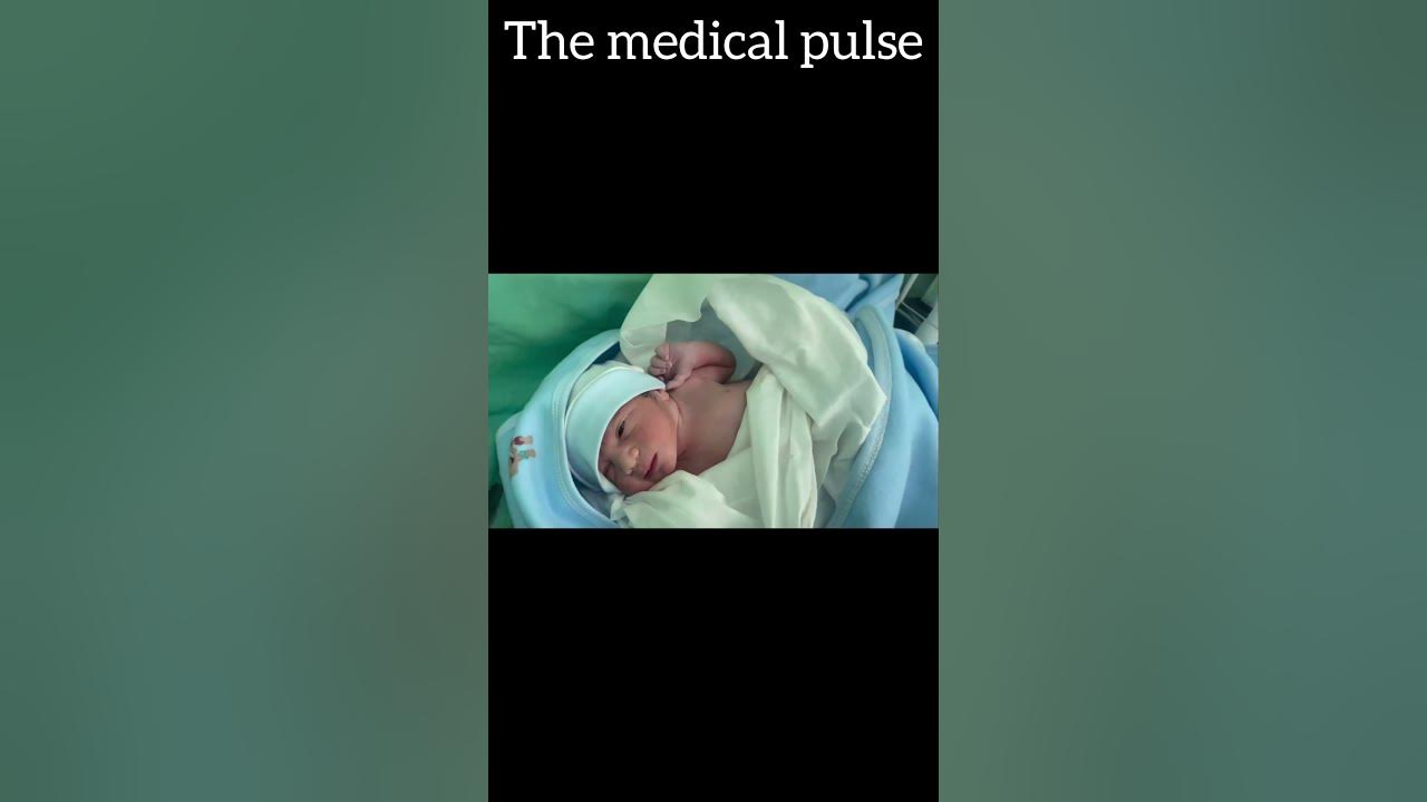 SMALL BABY IN CRITICAL CONDITION #song #trending #baby #birth #love #waterbirth #maa
