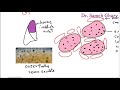Systemic Pathology 13 Respiratory System 1 Pneumonia And Lung Abscess DR SAMEH GHAZY 