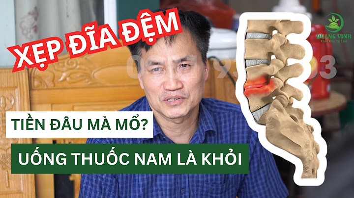 Thoái hóa mất nước đĩa đệm cột sống cổ năm 2024