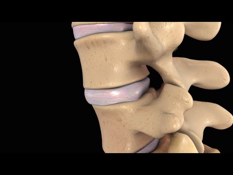 Dr. Ebraheim's educational animated video describes clinical test for lower back pain. Become a frie. 