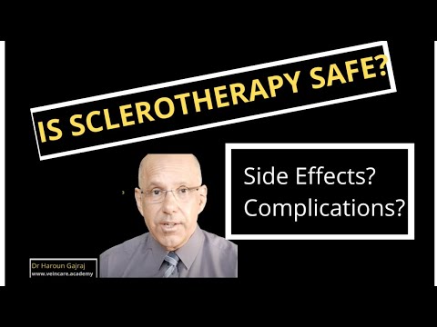 Is Sclerotherapy Safe?