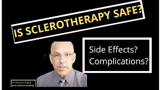 Is Sclerotherapy Safe? | Side Effects and Complications of Sclerotherapy