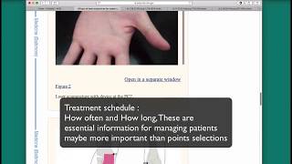 Finding acupuncture treatment modalities with Pubmed Central