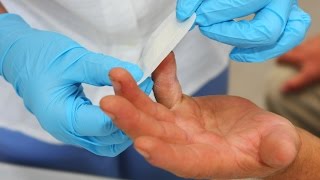 Diabetes and Skin Problems (Conditions A-Z)