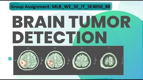 Brain Tumor Detection Using Deep Learning | Model Comparison (CNN, VGG19, InceptionV3, YOLOv11n)