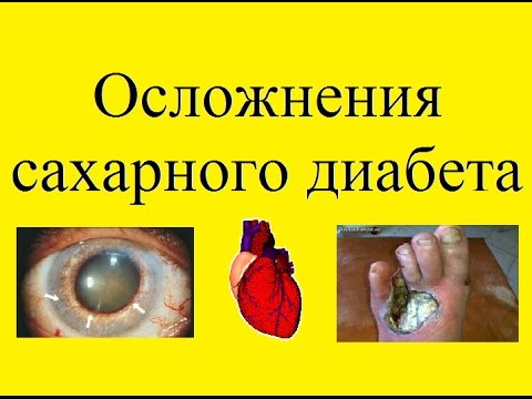 осложнения сахарного диабета осложнения сахарного диабета