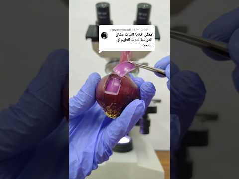 الخلايا النباتية تحت الميكروسكوب     