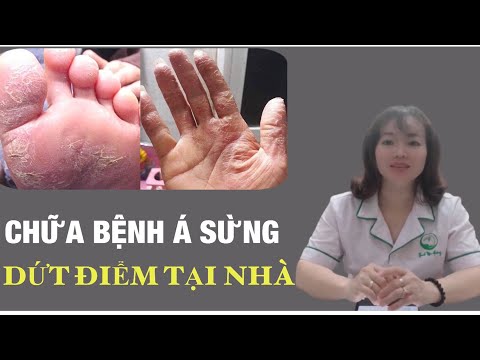 Video: Làm thế nào để chữa lành da khô trên chân (có hình ảnh)