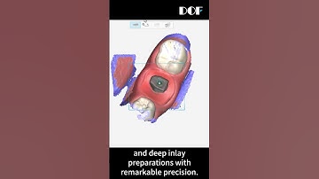 FREEDOM Air’s outstanding scanning depth