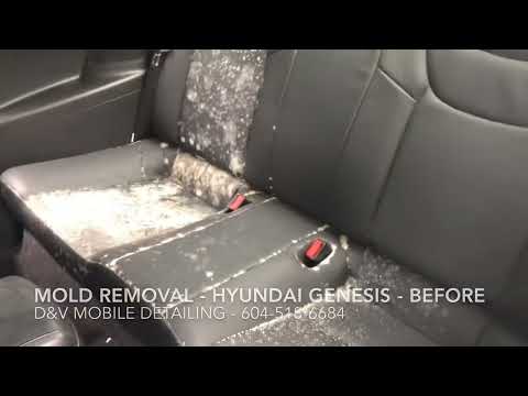 Vehicle Mold Removal near me from a Hyundai Genesis