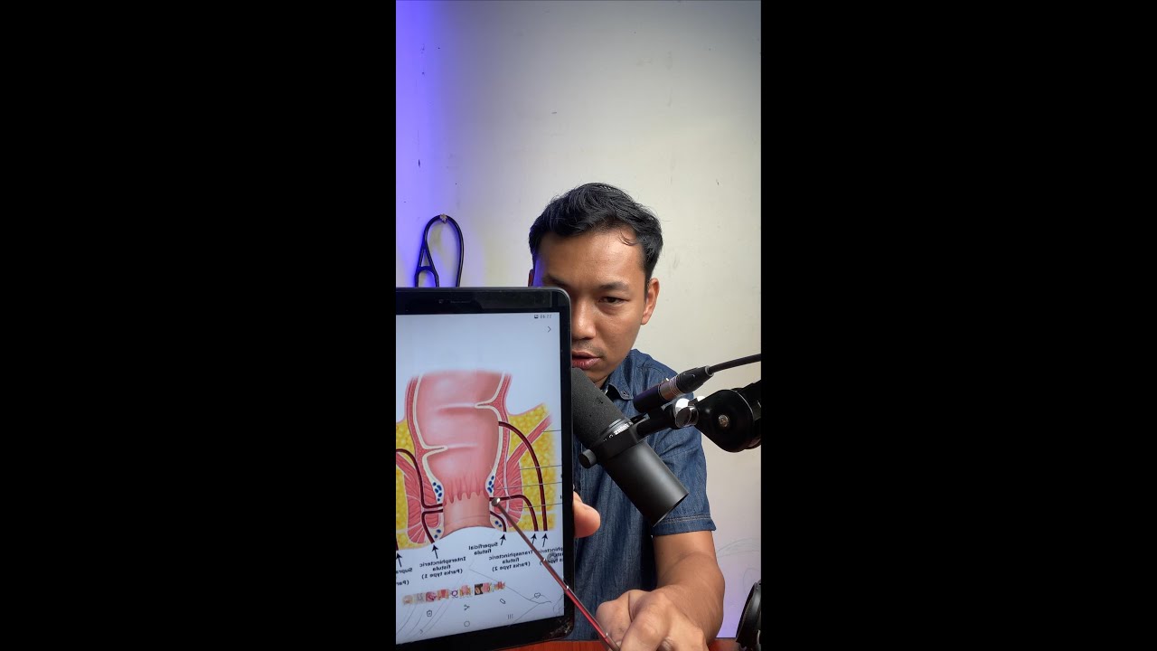 ဂရင်ဂျီနာဆိုတာဘာလဲ