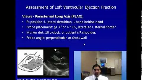 Echo Lecture - Determination of Left Ventricular Ejection Fraction