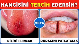 Hangisini TERCİH Edersin? Şimdiye Kadarki En Düşündürücü Sorular.! TERCİHİNİ Yap