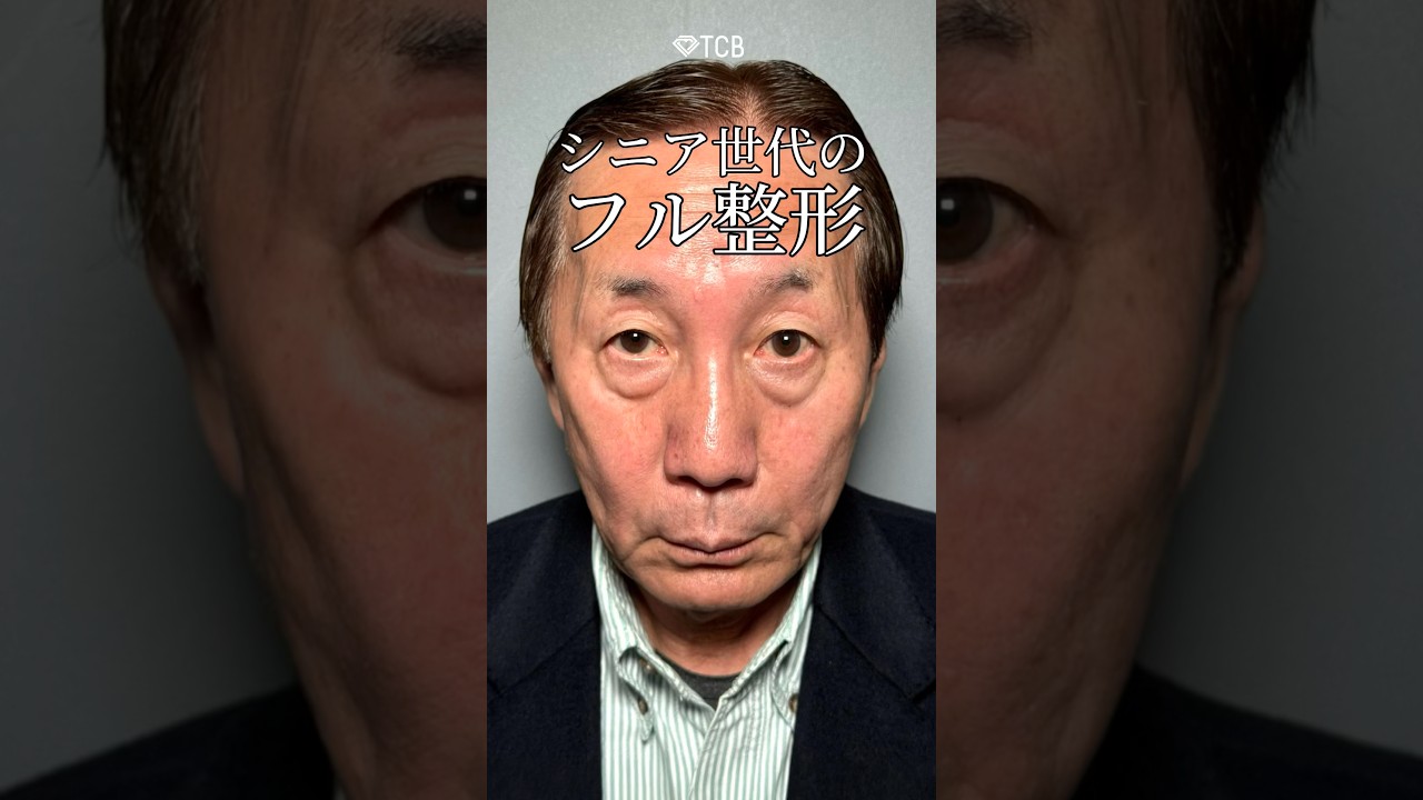【クマ取り】シニア世代のフル整形💉 #shorts
