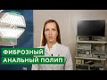 Фиброзный анальный полип / Лечение фиброзного анального полипа / Лечение полипа лазером