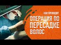 Как проходит операция по пересадке волос