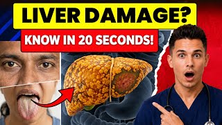 Is Your Liver Healthy on the Inside? Perform These 4 Home Tests in 20 Seconds!