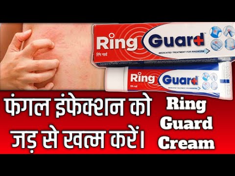 Ring guard Review | ring guard treatment | ring guard cream uses | ring  guard cream ke fayde - YouTube