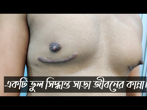 ভিডিও: সিলিকন কি পানির নিচে নিরাময় করবে?