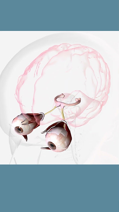 What is amblyopia?