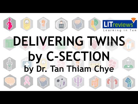 Delivering Twins by C Section by Dr Tan Thiam Chye