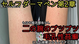 二の腕ブツブツ Youtube