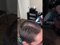 Barber cuts off lice must watch