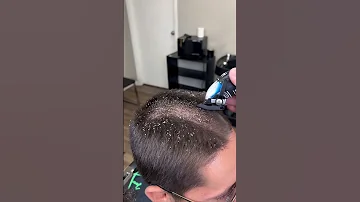 BARBER CUTS OFF LICE MUST WATCH 