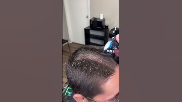 Thumbnail of BARBER CUTS OFF LICE!!!! MUST WATCH