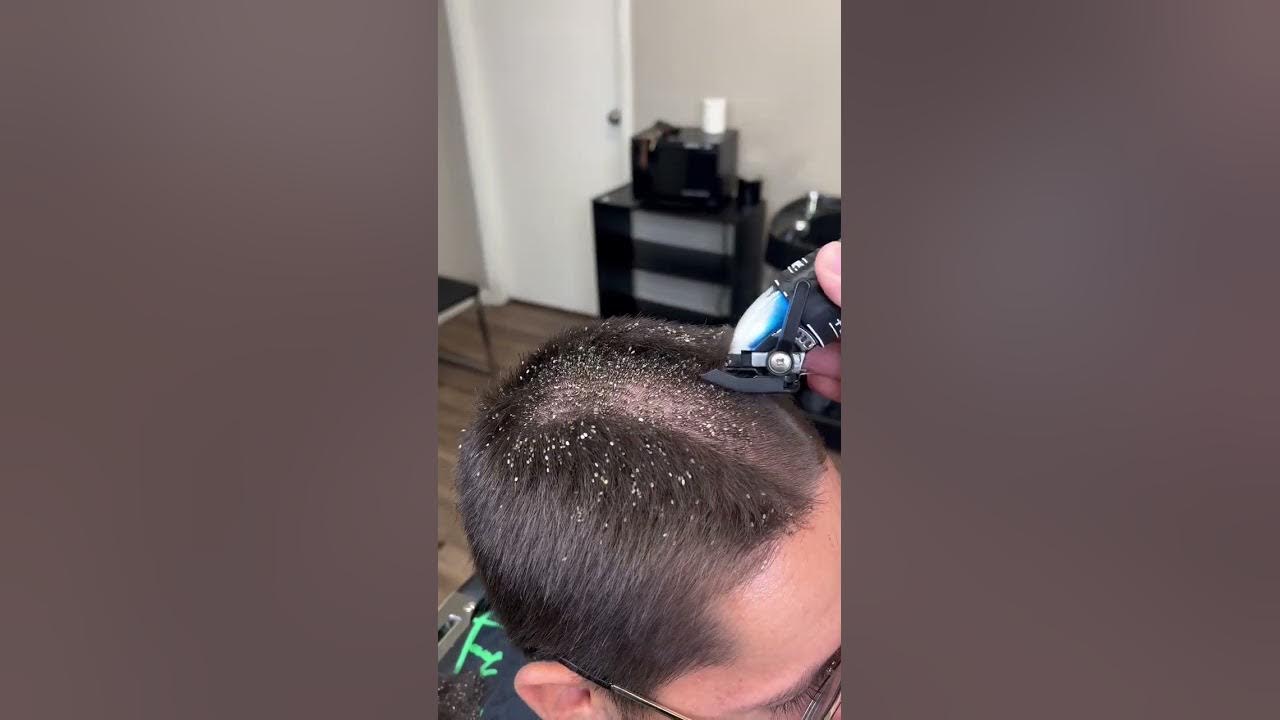 BARBER CUTS OFF LICE!!!! MUST WATCH