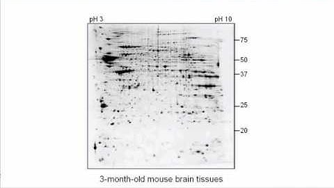 2D Gel Electrophoresis Applications