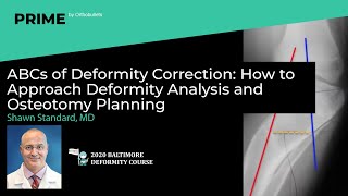 Deformity Correction: How to Approach Deformity Analysis & Osteotomy Planning - Shawn Standard, MD