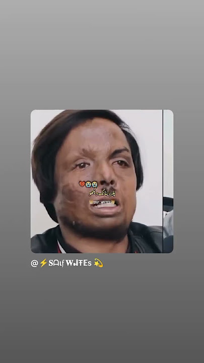 https://youtu.be/B-7V3JkNR3M?si=Jmzkog89p