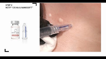 FILMMED NCTF 135 HA Injection on Neck (Official Tutorial Video)