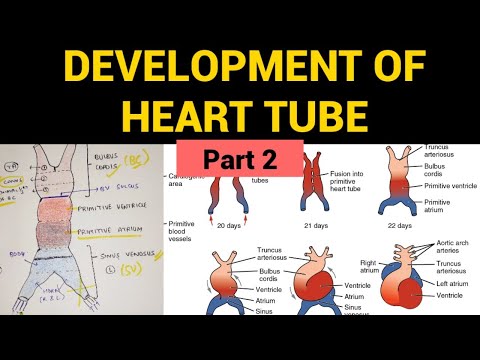 Development of Heart