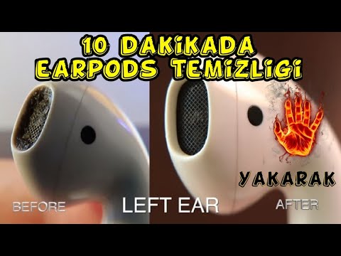 Video: Kulaklıklarımı Nasıl Temizlerim? IPhone Kulaklıklardan (Apple EarPods) Kulak Kiri Nasıl Temizlenir? Hidrojen Peroksit Ile Vakumlu Modellerin Temizlenmesi. Diğer Seçenekler