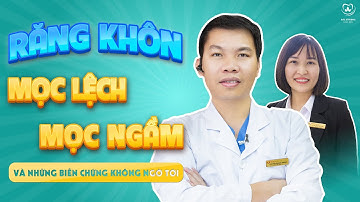 Răng Khôn Mọc Lệch - Mọc Ngầm Và Những Biến Chứng Không Ngờ Tới | Bác sĩ Trung Long Biên