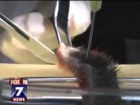 Hair Transplant on Fox 7, Austin Texas