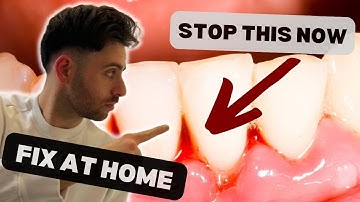 The Real Reason Your Gums Bleed (And What to Do About It)