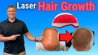 Laser Hair Growth Therapy for Male and Female Hair loss by Stronglife Physiotherapy 1,711 views 1 year ago 3 minutes, 12 seconds