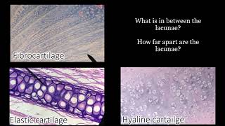 Identifying Cartilage | Review and Practice Questions