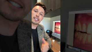 No Prep Vs Minimal Prep Veneers