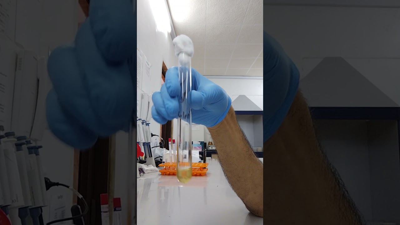 standard procedures for stool culture