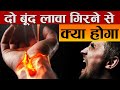 हाथ के ऊपर दो बूंद लावा गिरने से क्या होगा ? | What If 2 Drops of Lava Fell On Your Body? | FE #23