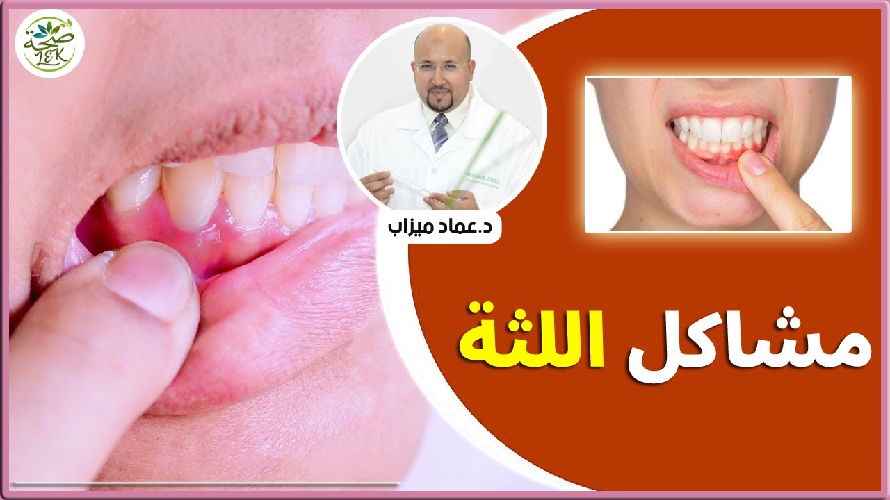 وصفة لعلاج مشاكل اللثة من عند الدكتور عماد ميزاب