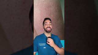 Rough Bumpy Skin? Urea