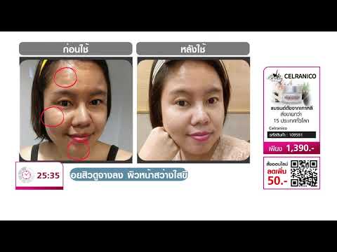 【Full Version】ครีมบำรุงผิวหน้า Celranico Snail Hydration Premium