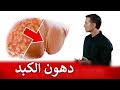 دهون الكبد | أفضل تمرين للتخلص من الدهون المتراكمة على الكبد