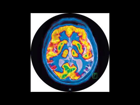 Frankey - Condesa